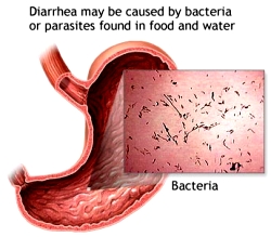 Diarrhea